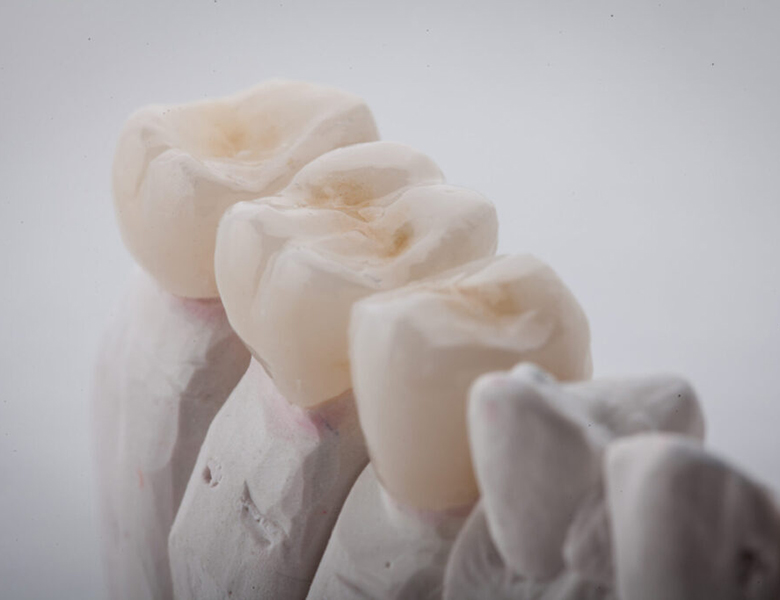 外苑前（東京）の歯医者、Angel矯正歯科・歯科口腔外科の自費専門の強み