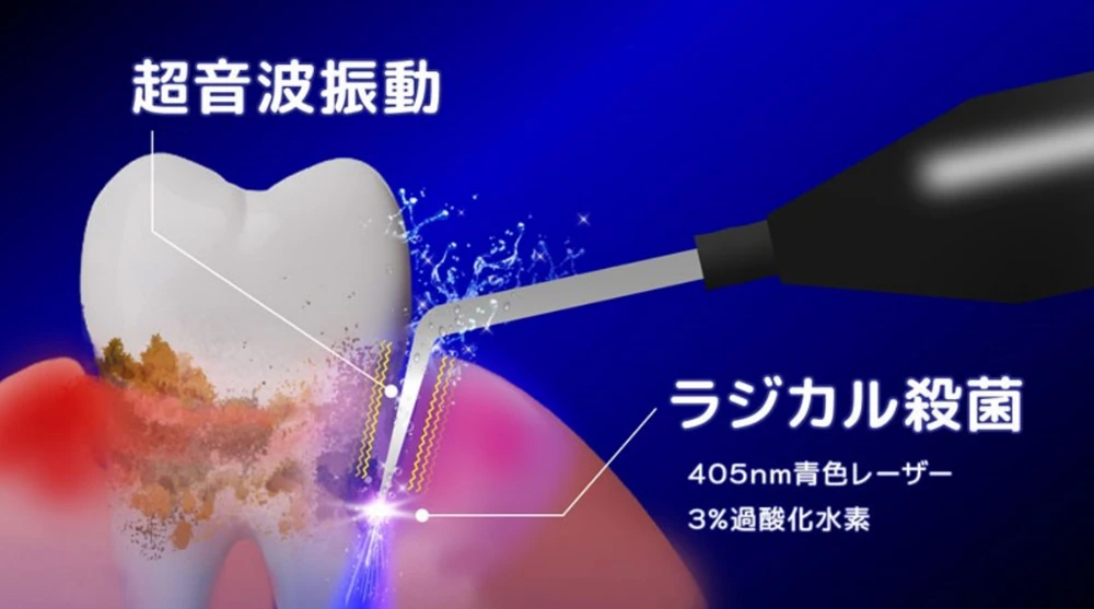 外苑前（東京）の歯医者、Angel矯正歯科・歯科口腔外科でブルーラジカル治療