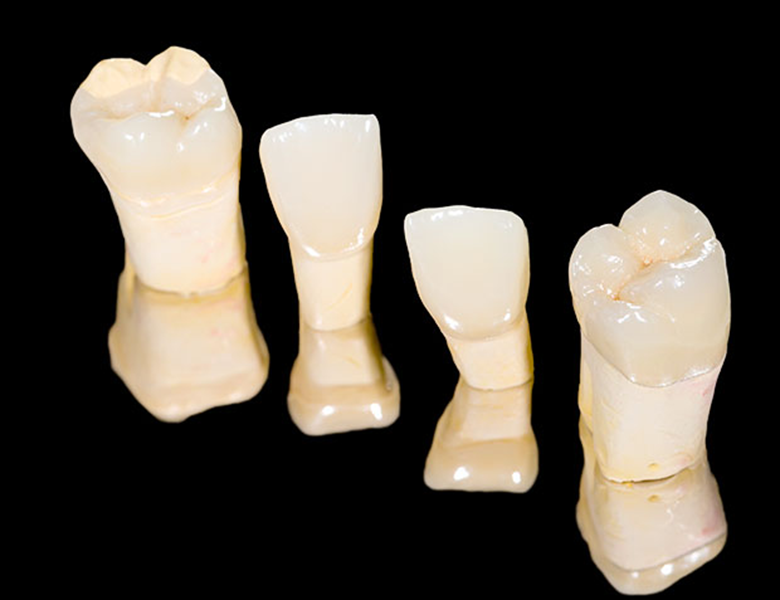 外苑前（東京）の歯医者、Angel矯正歯科・歯科口腔外科でむし歯治療