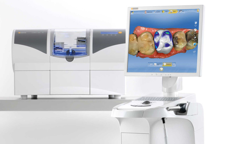 外苑前（東京）の歯医者、Angel矯正歯科・歯科口腔外科のセレック(CEREC)治療