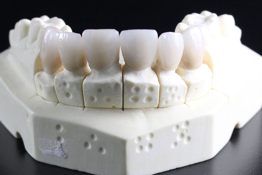 外苑前（東京）の歯医者、Angel矯正歯科・歯科口腔外科は院内技工室完備