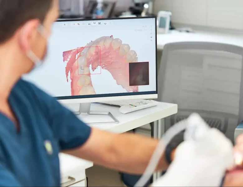 外苑前（東京）の歯医者、Angel矯正歯科・歯科口腔外科のセレック(CEREC)治療