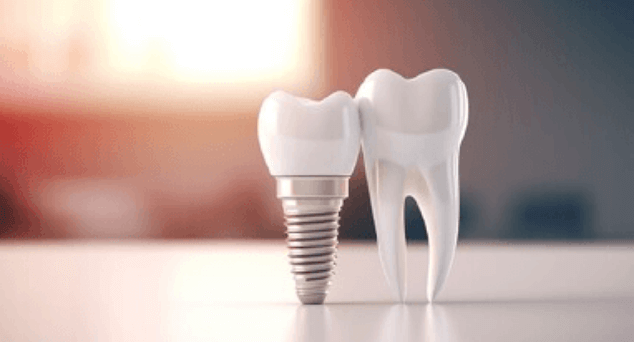 外苑前（東京）の歯医者、Angel矯正歯科・歯科口腔外科でインプラント