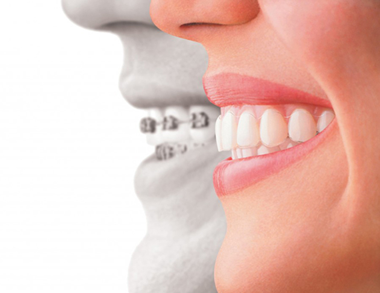 外苑前（東京）の歯医者、Angel矯正歯科・歯科口腔外科で矯正歯科