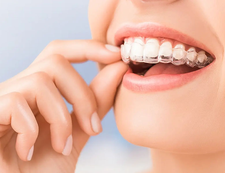 外苑前（東京）の歯医者、Angel矯正歯科・歯科口腔外科で矯正歯科