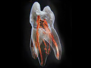 外苑前（東京）の歯医者、Angel矯正歯科・歯科口腔外科で歯科用CT精密診断