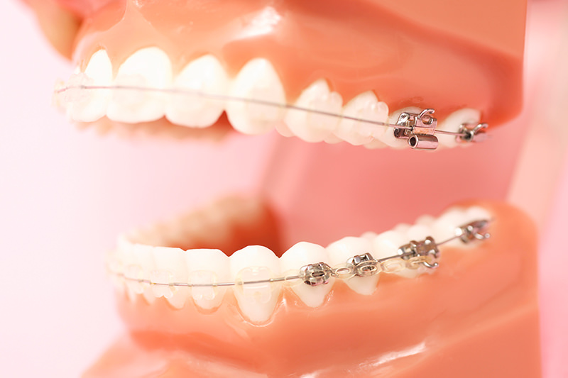 外苑前（東京）の歯医者、Angel矯正歯科・歯科口腔外科で親知らずの抜歯