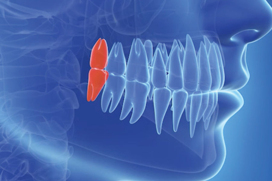 外苑前（東京）の歯医者、Angel矯正歯科・歯科口腔外科で親知らずの抜歯