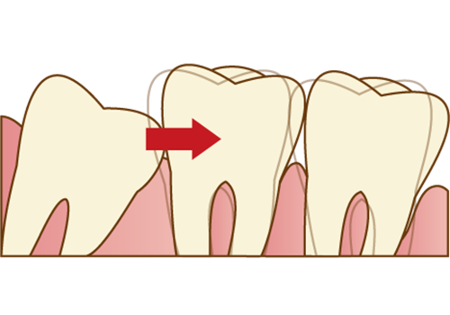 外苑前（東京）の歯医者、Angel矯正歯科・歯科口腔外科で親知らずの抜歯