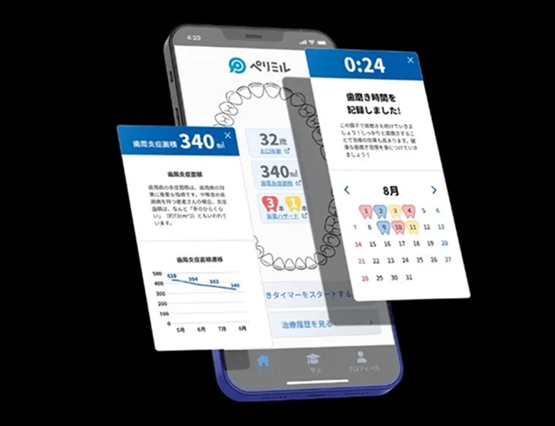 外苑前（東京）の歯医者、Angel矯正歯科・歯科口腔外科でブルーラジカル治療