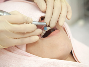 外苑前（東京）の歯医者、Angel矯正歯科・歯科口腔外科で予防歯科