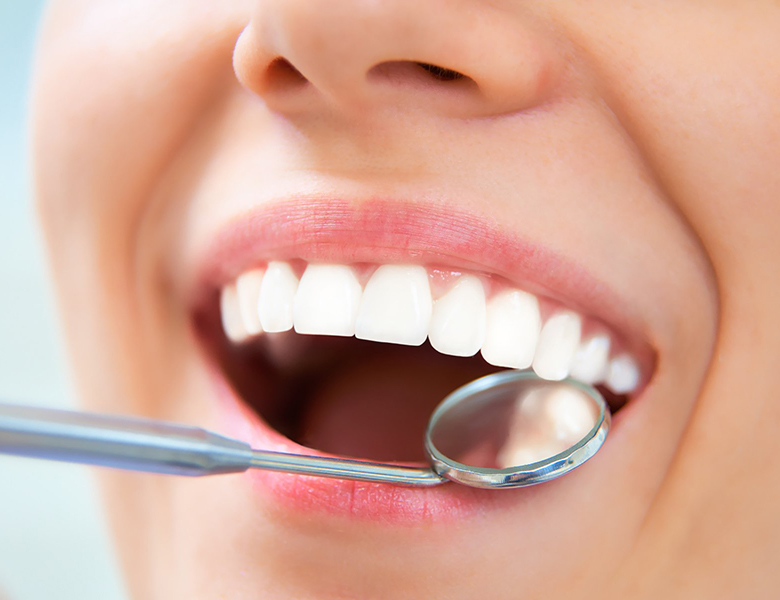 外苑前（東京）の歯医者、Angel矯正歯科・歯科口腔外科の予防歯科